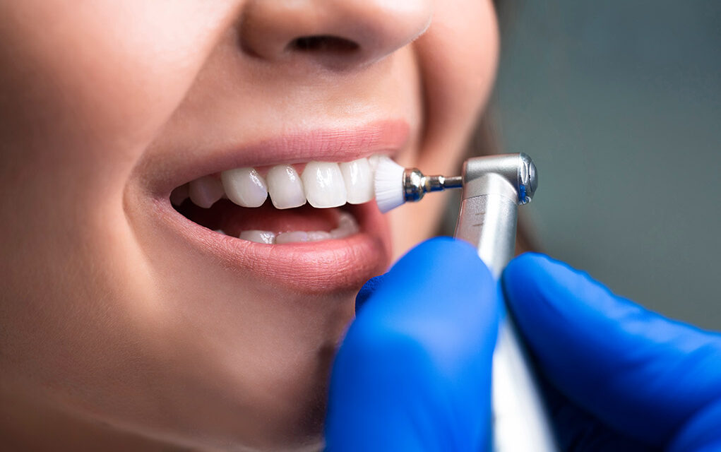 Tratamiento de Limpieza dental en Dental Family Center