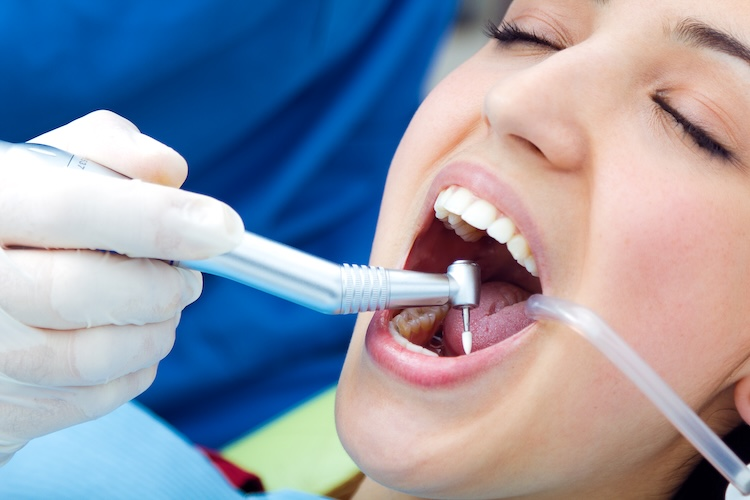 Tratamiento de Endodoncia en Dental Family Center